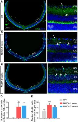 Stimulation of C-Kit+ Retinal Progenitor Cells by Stem Cell Factor Confers Protection Against Retinal Degeneration